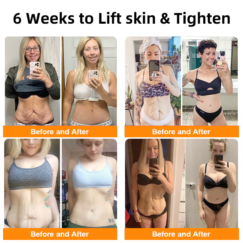 EXPECTSKY™ Ion Lifting & Lymphvity Detoxification Bra👙