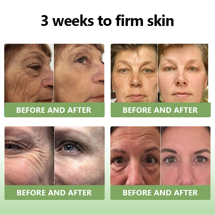 Awzlove™ Luxurious Collagen Firming Cream(🔥80% Off for a Limited Time!)✨