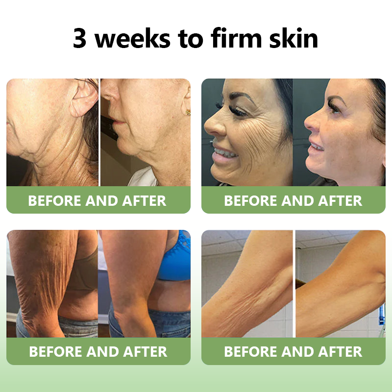Awzlove™ Luxurious Collagen Firming Cream(🔥80% Off for a Limited Time!)✨