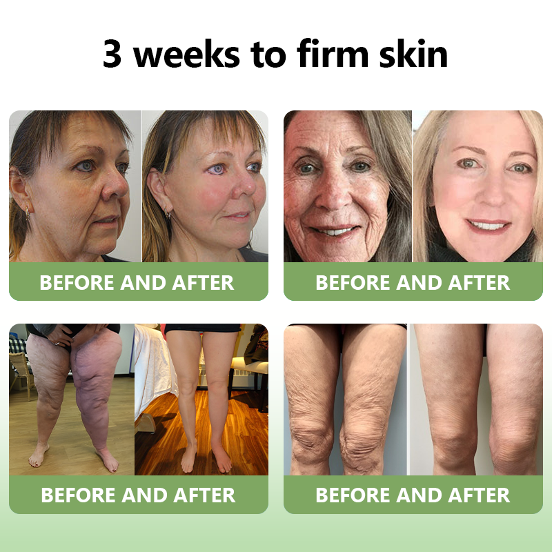 Awzlove™ Luxurious Collagen Firming Cream(🔥80% Off for a Limited Time!)✨
