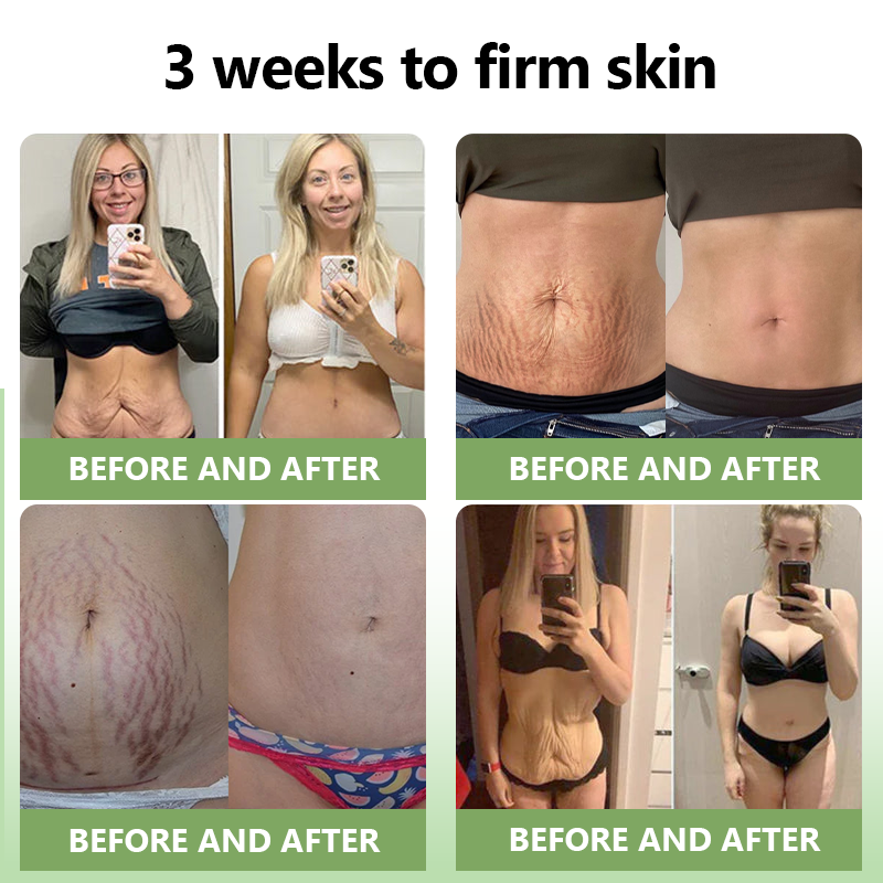 Awzlove™ Luxurious Collagen Firming Cream(🔥80% Off for a Limited Time!)✨