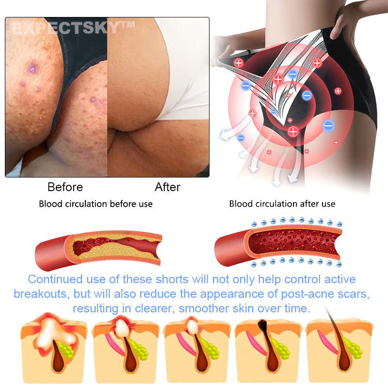 【Efficient and Healthy】EXPECTSKY™ Fat-Burning Ice Silk 💌💌 Peptide-Ion Fiber Shaping Shorts