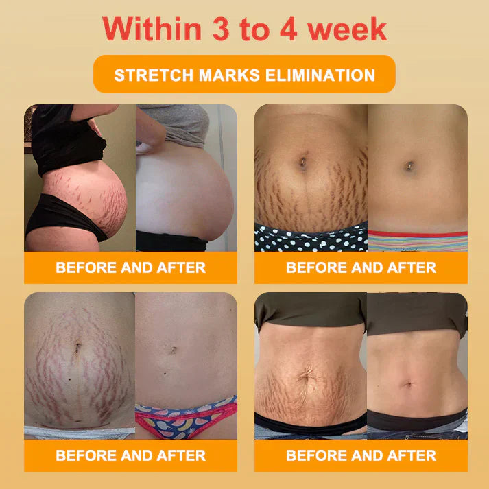 【Efficient and Healthy】EXPECTSKY™ Fat-Burning Ice Silk 💌💌 Peptide-Ion Fiber Shaping Shorts
