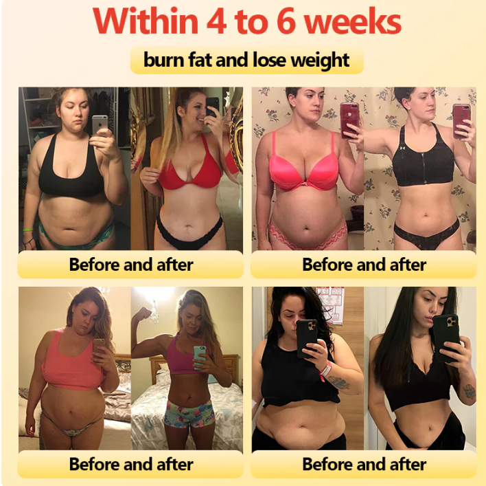 EXPECTSKY™ Ion Lifting & Lymphvity Detoxification Bra👙