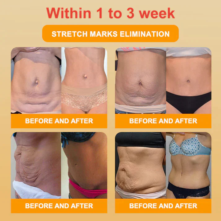【Efficient and Healthy】EXPECTSKY™ Fat-Burning Ice Silk 💌💌 Peptide-Ion Fiber Shaping Shorts