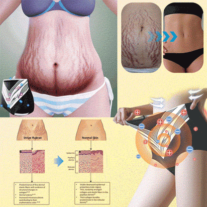 【Efficient and Healthy】EXPECTSKY™ Fat-Burning Ice Silk 💌💌 Peptide-Ion Fiber Shaping Shorts