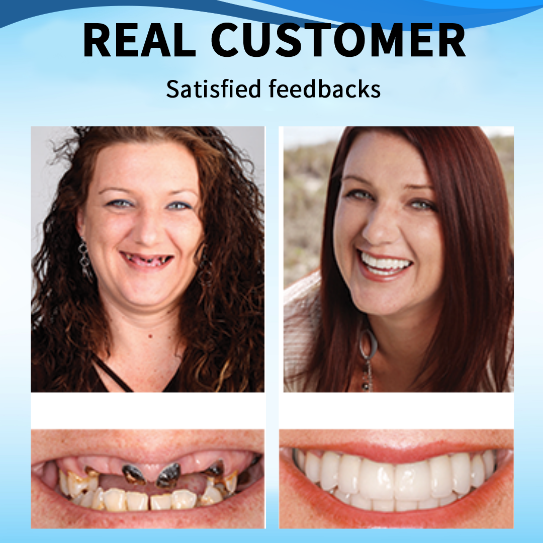 TIMNAMY™ Silicone Reline Denture Set