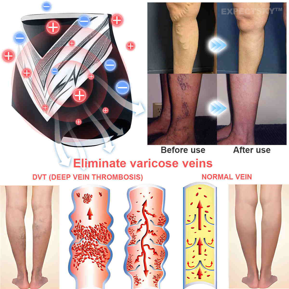 【Efficient and Healthy】EXPECTSKY™ Fat-Burning Ice Silk 💌💌 Peptide-Ion Fiber Shaping Shorts