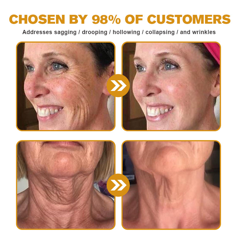 Made and shipped from the AU✅-Awzlove™ Botox Bee Venom Wrinkle Removal Cream-Last Day Promotion 70% OFF🐝