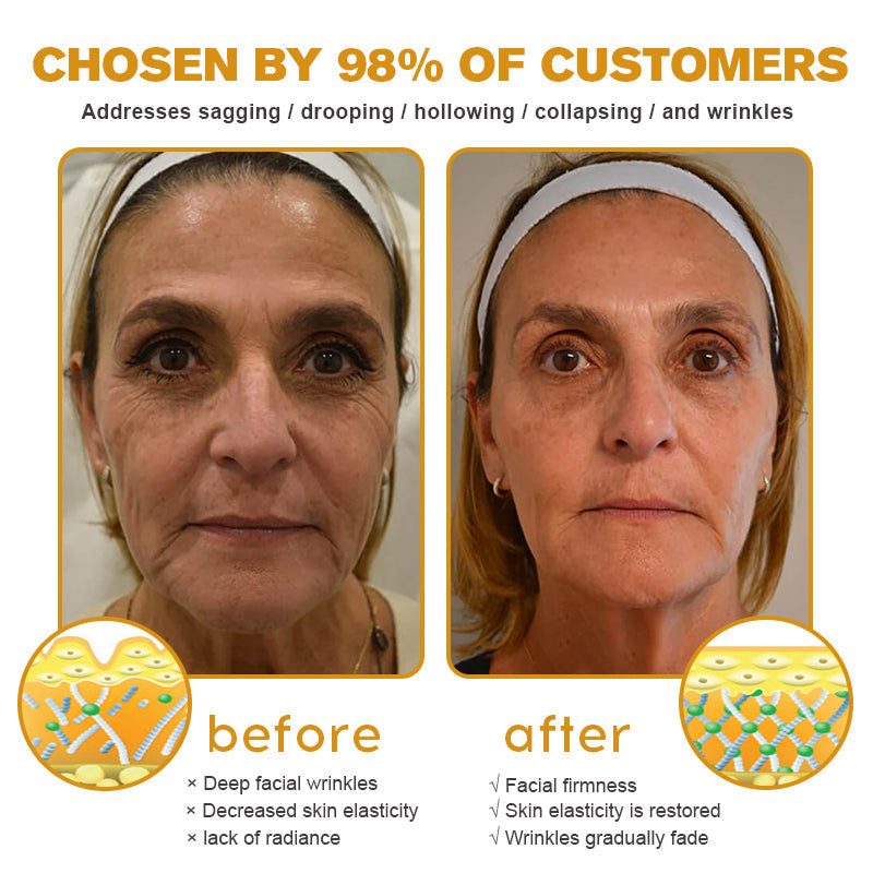 Made and shipped from the AU✅-Awzlove™ Botox Bee Venom Wrinkle Removal Cream-Last Day Promotion 70% OFF🐝