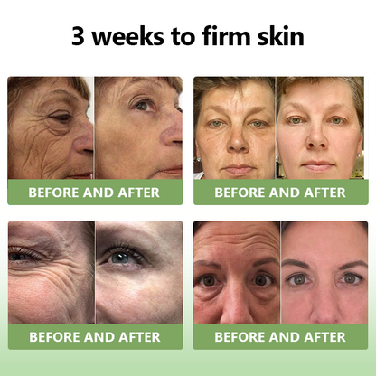 Awzlove™ Luxurious Collagen Firming Cream(🔥80% Off for a Limited Time!)✨