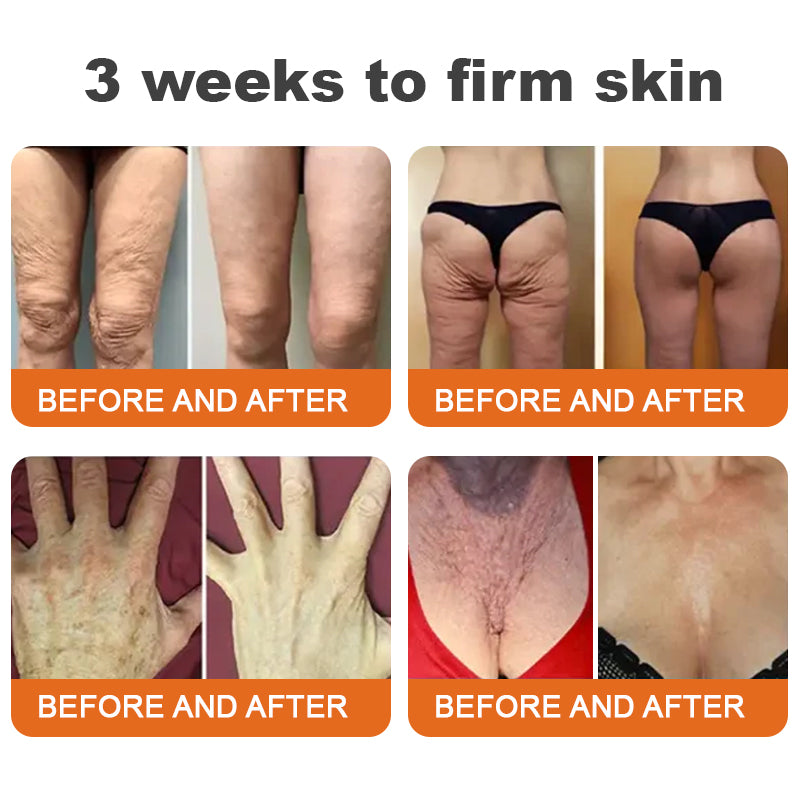 Awzlove™ AH-8 Bee Venom Firming Total-lift Body Cream | Clinically Tested by Dermatologists🐝