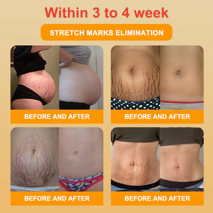 【Efficient and Healthy】EXPECTSKY™ Fat-Burning Ice Silk 💌💌 Peptide-Ion Fiber Shaping Shorts