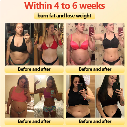 EXPECTSKY™ Ion Lifting & Lymphvity Detoxification Bra👙