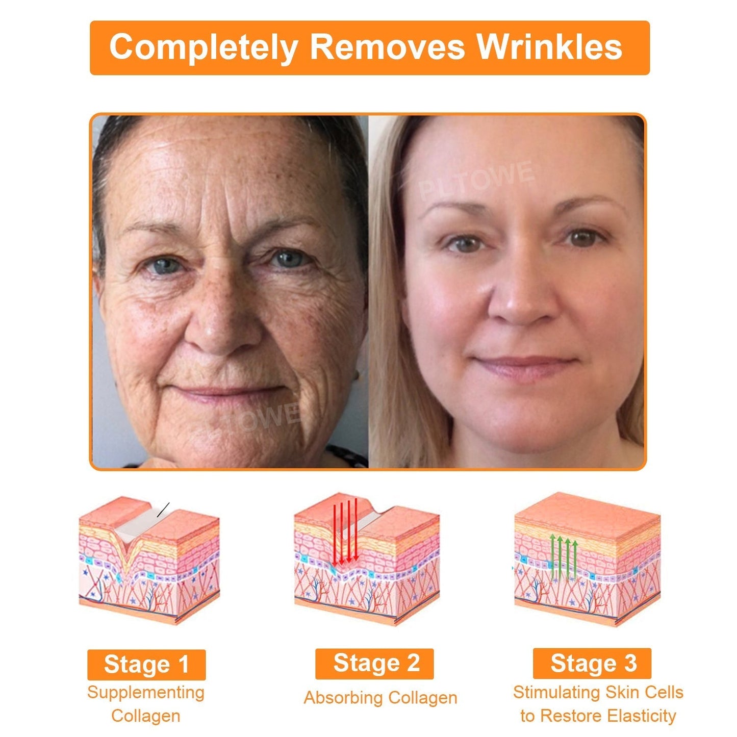 Awzlove™  Powerful All-Body Skin Treatment Cream👩‍⚕️ACD Recommends (🔥Limited time 50% discount)