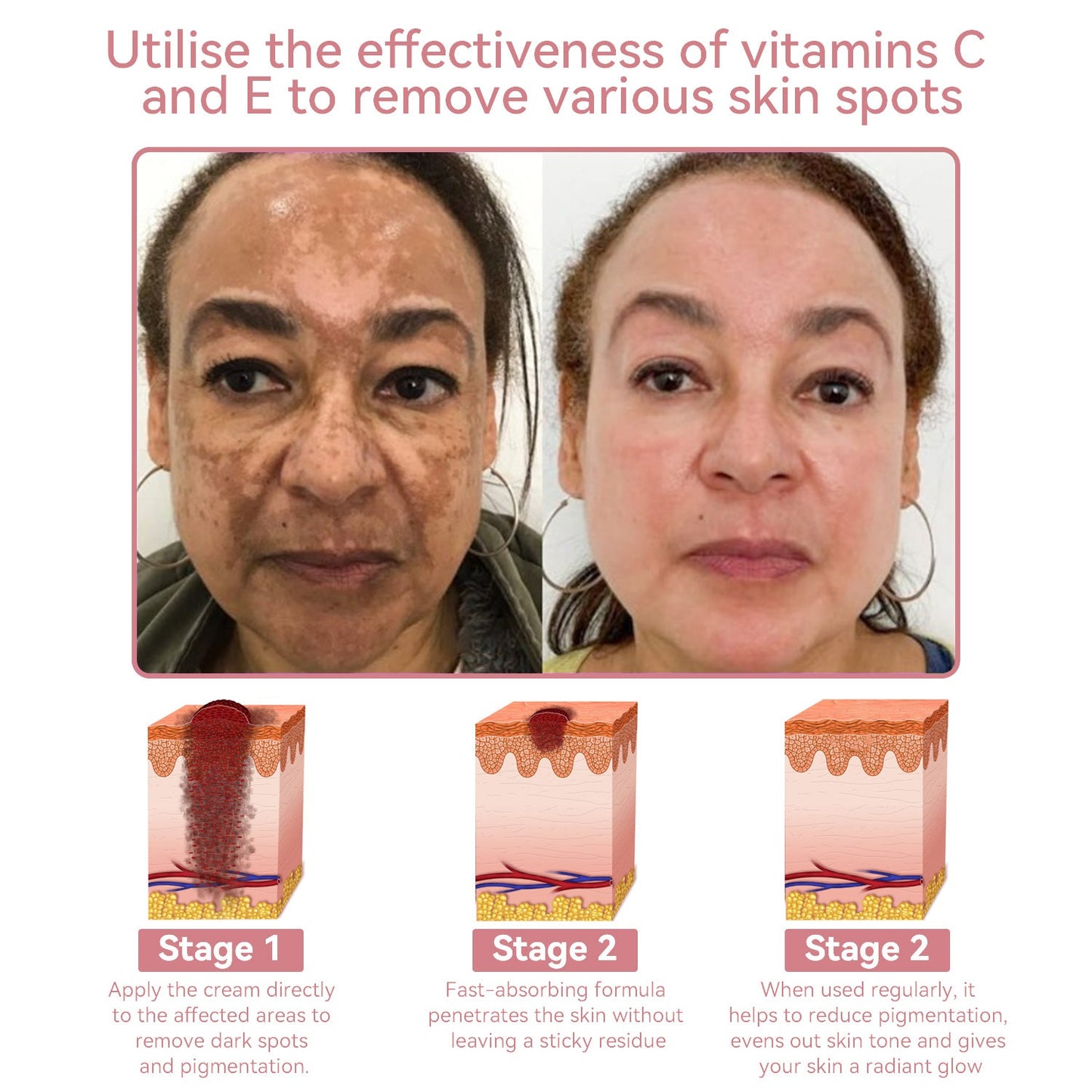 Coenzyme Q10 Collagen Jelly Skin Cream--Christmas promotion, up to 80% discount, Australia News reported products 💝