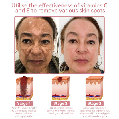 Coenzyme Q10 Collagen Jelly Skin Cream--Christmas promotion, up to 80% discount, Australia News reported products 💝