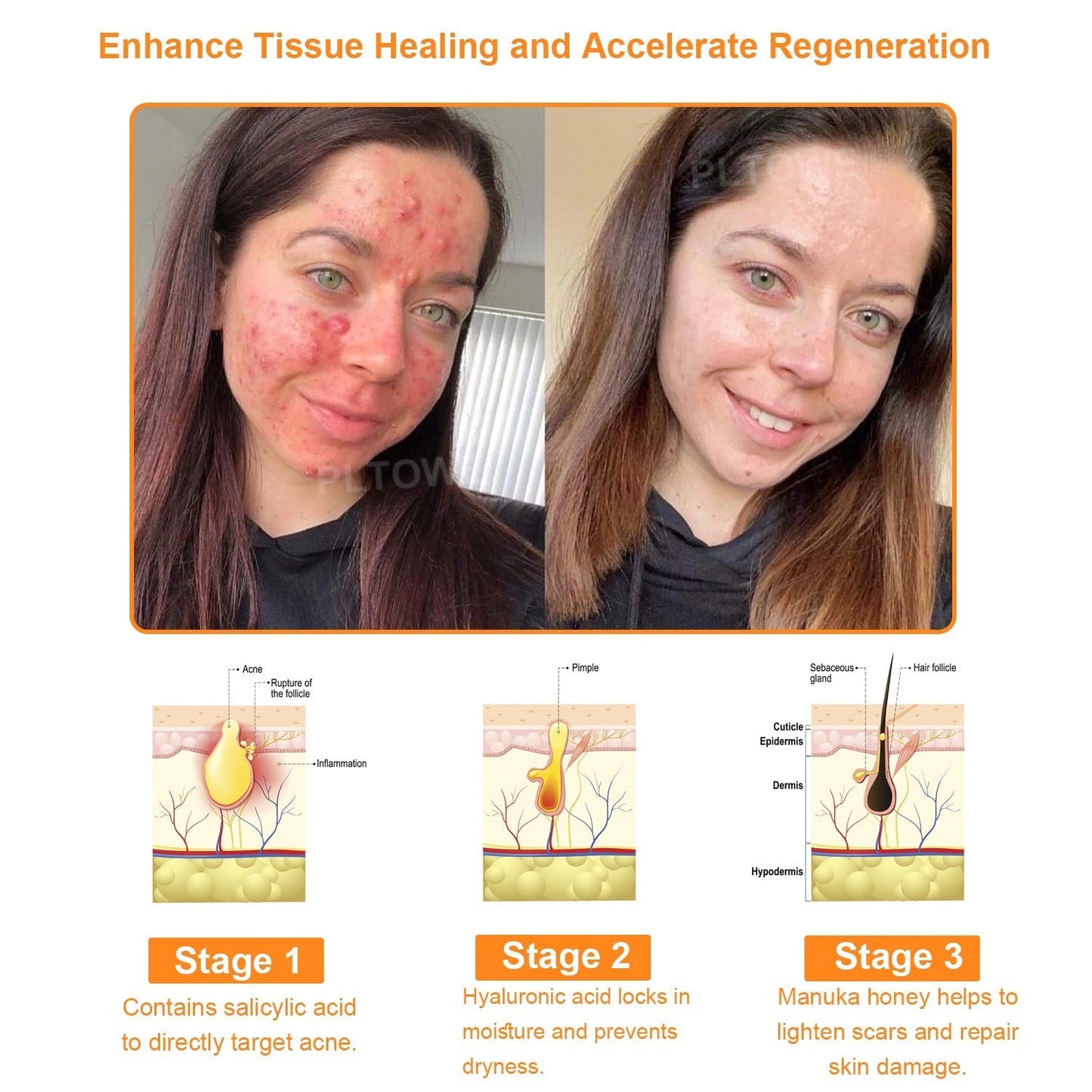Awzlove™  Powerful All-Body Skin Treatment Cream👩‍⚕️ACD Recommends (🔥Limited time 50% discount)