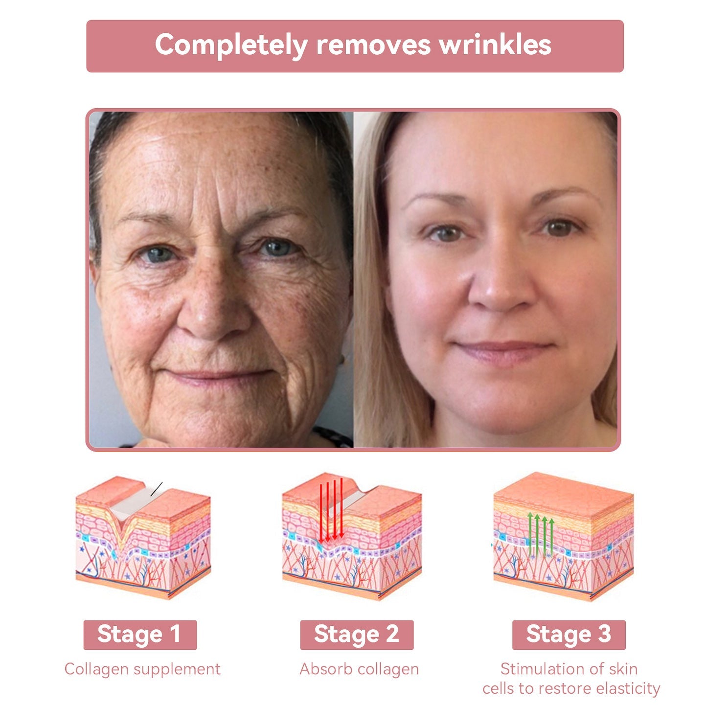 Coenzyme Q10 Collagen Jelly Skin Cream--Christmas promotion, up to 80% discount, Australia News reported products 💝