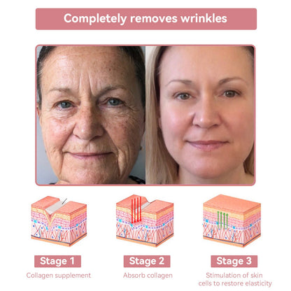 Coenzyme Q10 Collagen Jelly Skin Cream--Christmas promotion, up to 80% discount, Australia News reported products 💝