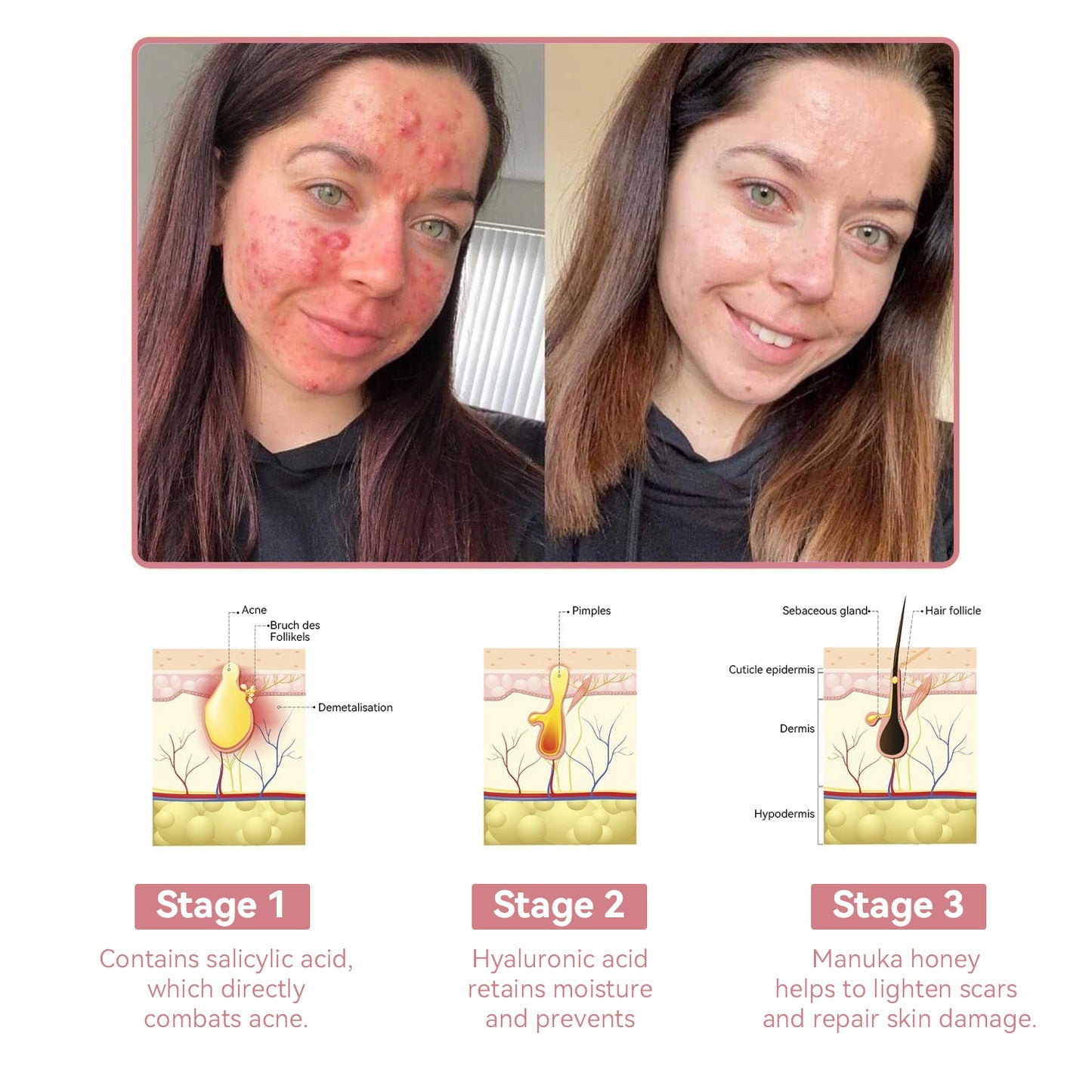 Coenzyme Q10 Collagen Jelly Skin Cream--Christmas promotion, up to 80% discount, Australia News reported products 💝