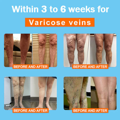 [Official Brand Store] PEARLMOON™ Ionic Correction Lymphatic Detoxification Long Tube Silk Stockings (⭐⭐⭐⭐⭐limited time offer, lasts 30 minutes)🎭