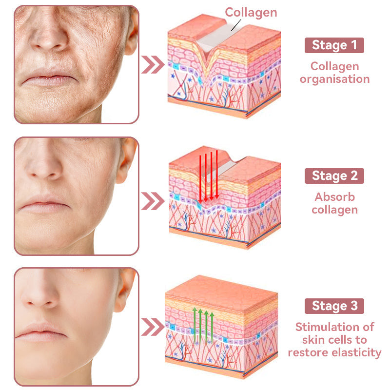 Coenzyme Q10 Collagen Jelly Skin Cream--Christmas promotion, up to 80% discount, Australia News reported products 💝