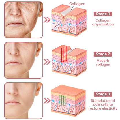 Coenzyme Q10 Collagen Jelly Skin Cream--Christmas promotion, up to 80% discount, Australia News reported products 💝
