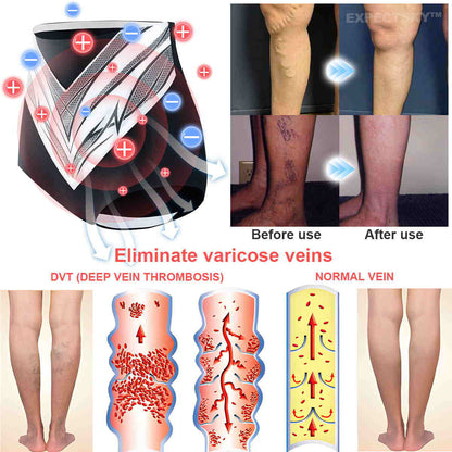 【Efficient and Healthy】EXPECTSKY™ Fat-Burning Ice Silk 💌💌 Peptide-Ion Fiber Shaping Shorts