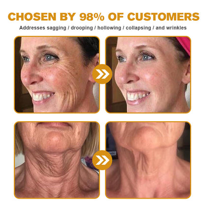 Made and shipped from the AU✅-Awzlove™ Botox Bee Venom Wrinkle Removal Cream-Last Day Promotion 70% OFF🐝