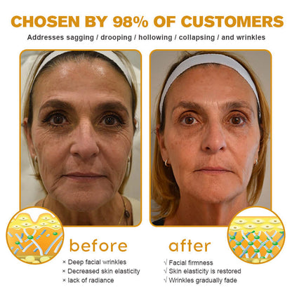 Made and shipped from the AU✅-Awzlove™ Botox Bee Venom Wrinkle Removal Cream-Last Day Promotion 70% OFF🐝
